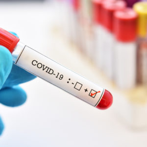Prevalenza della Sierologia SARS-Cov-2 nei donatori di sangue nella Azienda Usl Umbria 2 durante la fase 3 dell’epidemia Covid-19 – Studio Osservazionale Prospettico